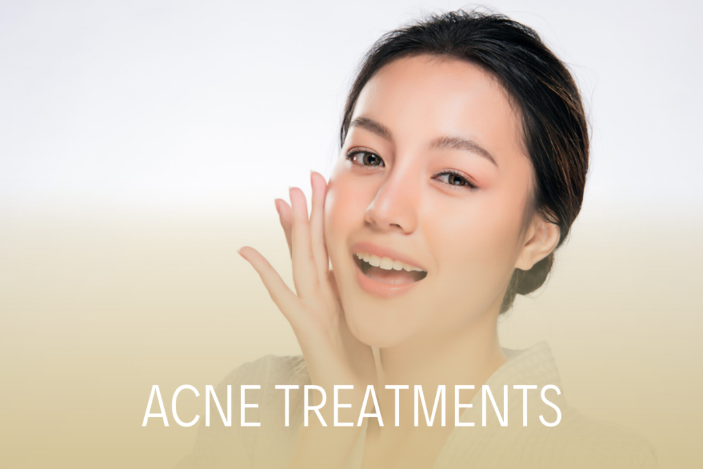Acne Treatments Baltimore Maryland