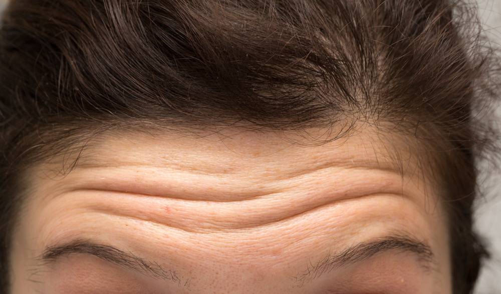 Botox for Forehead Lines
